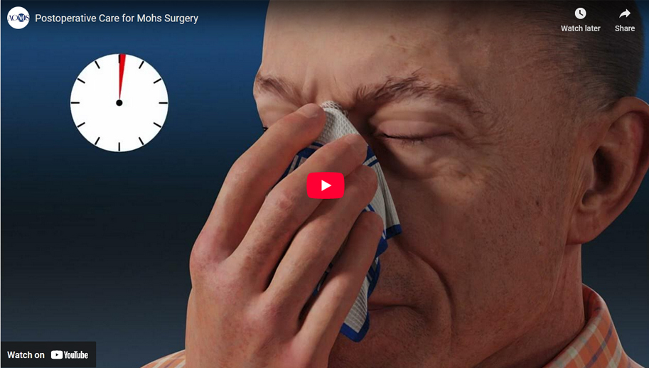 Postoperative Care for Mohs Surgery